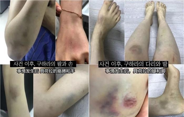 韩国女星被男友以性爱视频威胁：从阿娇到具荷拉，为何受伤害的总是女性？