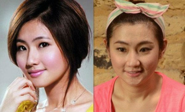 俞灏明烧伤程度严重为什么任家萱恨他？任家萱俞灏明烧伤原因揭秘