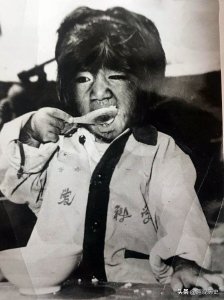 ​“毛孩”于震寰：从小浑身长满黑毛，43年前火遍全国，如今怎样了