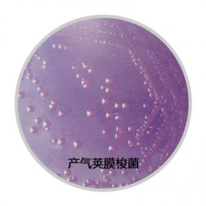 ​人畜共患病原菌——产气荚膜梭菌