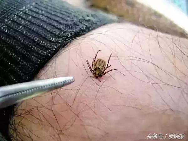 蜱虫会飞吗(请问蜱虫有翅膀会飞吗)