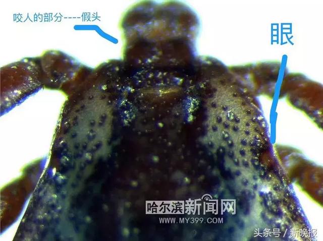 蜱虫会飞吗(请问蜱虫有翅膀会飞吗)