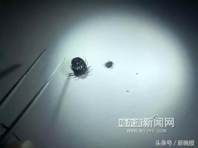 蜱虫会飞吗(请问蜱虫有翅膀会飞吗)