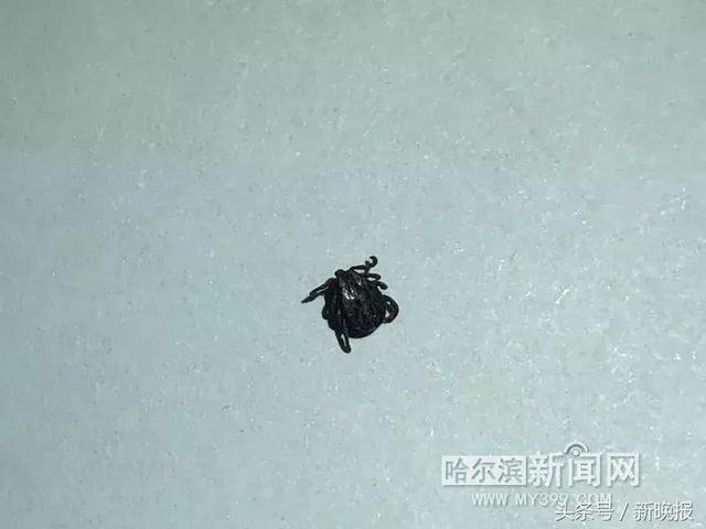 蜱虫会飞吗(请问蜱虫有翅膀会飞吗)