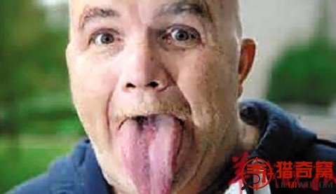 世界最长舌:英国长舌男舌长9.8厘米