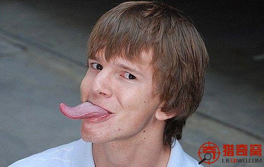 最长舌头9厘米长 舔眼睛很容易