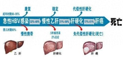 ​中医世家田维君告知大家肝病的各种症状！