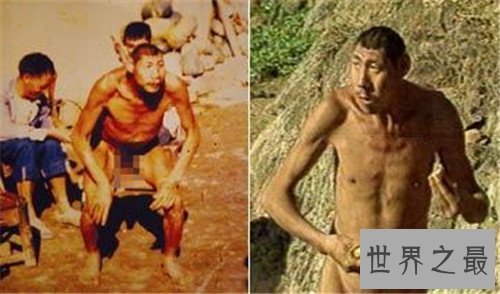 猴娃之谜的真相是什么 科学家表示竟然是这种病