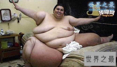 世界第一胖人,苏珊娜.埃曼重达1450斤(图片)