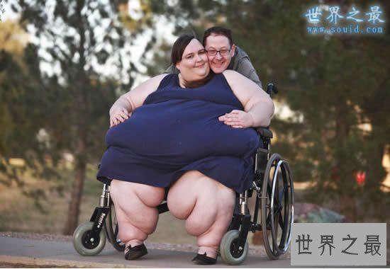 世界第一胖人,苏珊娜.埃曼重达1450斤(图片)