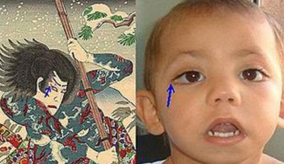 ​歌舞伎面谱综合症真的漂亮吗，美中带刺(令人惋惜)