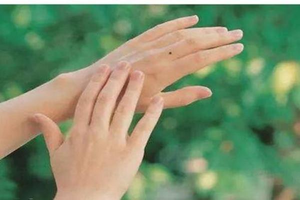 手指被夹淤血怎么办 指甲淤血要放血吗