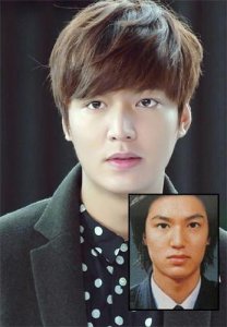 ​李明浩整容，正规整形整容