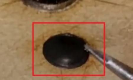 缝纫机跳线，缝纫机一段一段跳线是什么原因？图5