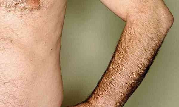 为什么毛越刮越粗原理,为什么毛会越刮越粗图4