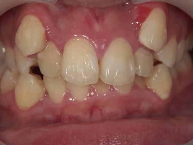 日本人为什么早餐后才刷牙（日本人何故中午排队刷牙）(17)