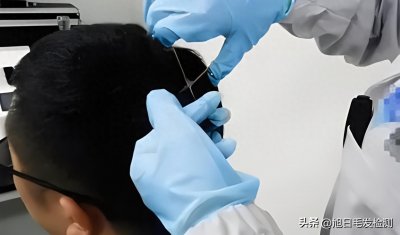 ​毛发检测毒一年能查出来吗