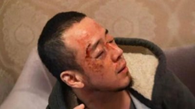 ​“杨坤演出结束被打”？本人回应