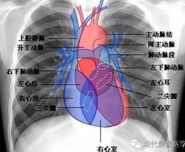 ​详尽的胸部CT影像示意图