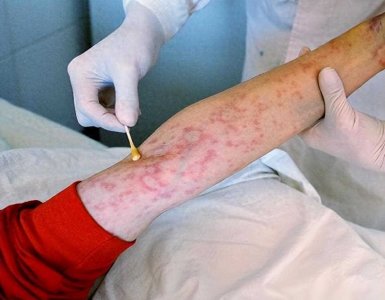 ​19年前，那个被黑人男友传染艾滋病的女学生朱力亚，后来怎样了