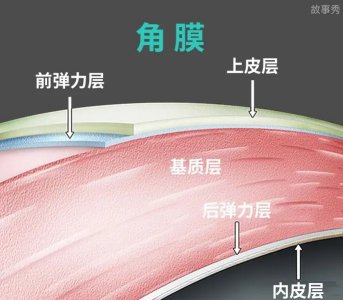 ​近视手术价格一览表 近视手术会带来哪些后遗症