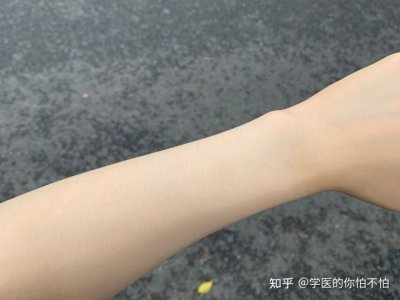 简单快速的美白方法（如何快速变白？特别是脸）