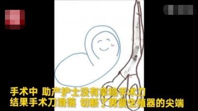 ​护士为男婴割包皮 手滑切断其生殖器 陪审团：赔他个2亿！